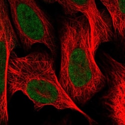 CGGBP1 Antibody, Novus Biologicals 0.1mL; Unlabeled:Antibodies, Polyclonal
